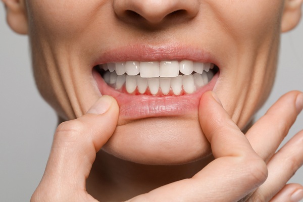Silent And Dangerous: The Impact Of Gum Disease On Your Health
