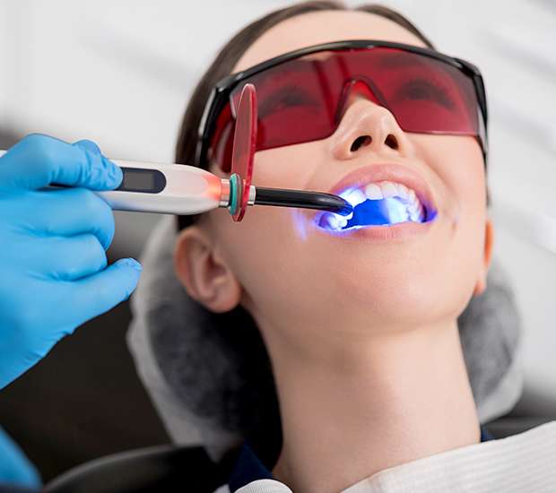 Memphis Professional Teeth Whitening