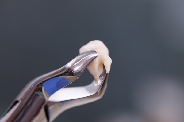 Dos And Don&#    ;ts Of Tooth Extraction Aftercare