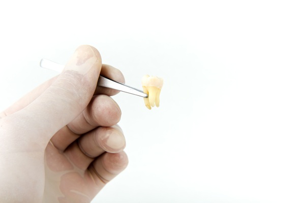 How To Care For Your Teeth After A Tooth Extraction